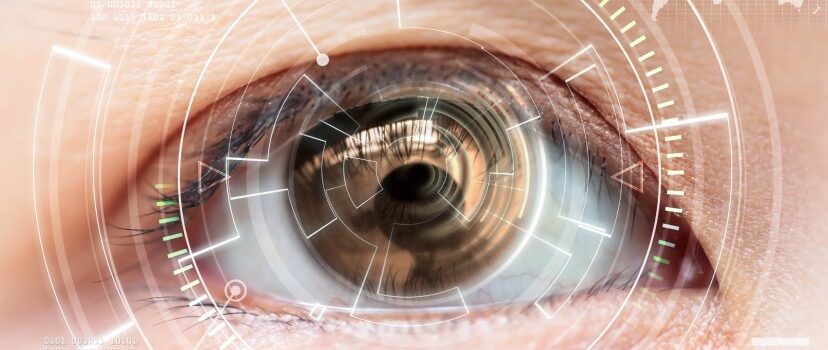 LASIK